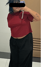 Daniela before starting treatment