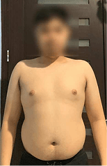 Jess before starting treatment