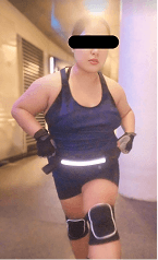 Jessie before starting treatment